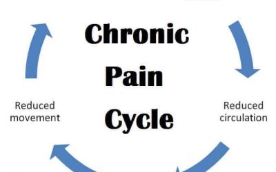 Chronic Pain Syndrome Management and Treatment